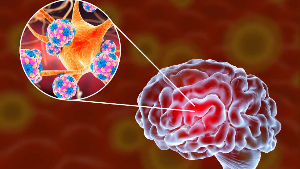 foto da not&iacute;cia